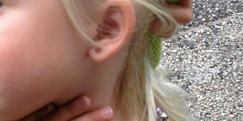 Barnläkare Ola Andersson rekommenderar att inte låta barnen få hål i öronen före fyra till sex års ålder, som barnet på denna bild. 