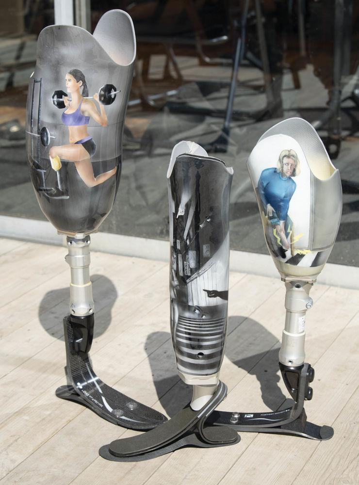 Hon har nu kombinerat sina erfarenheter med sitt konstnärliga kunnande och skapat spraymålade proteser som speglar tre faser i perioden efter hennes amputation. 