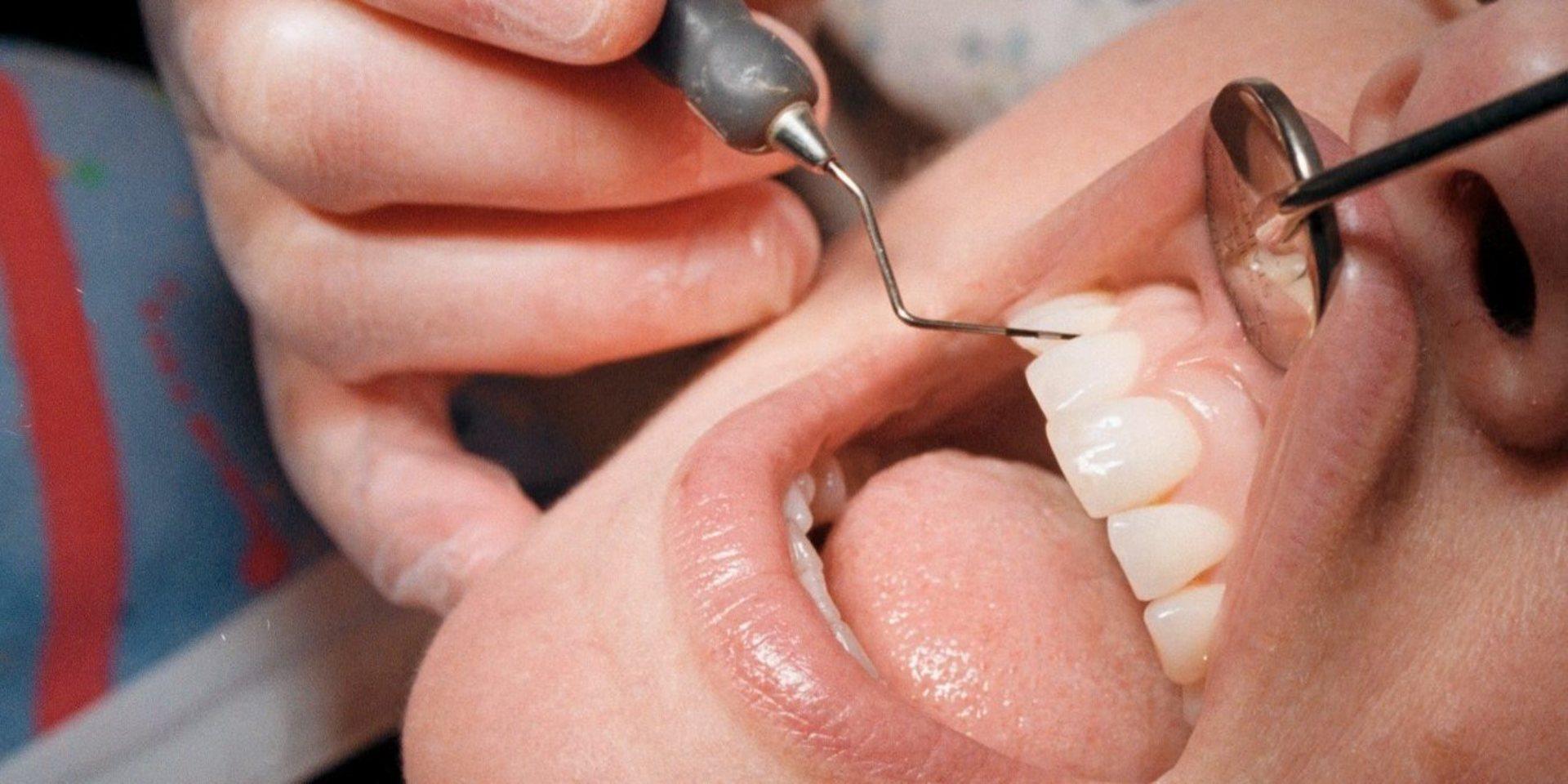 När många avbokar sina besök nu riskerar tandvården långa väntetider längre fram.
