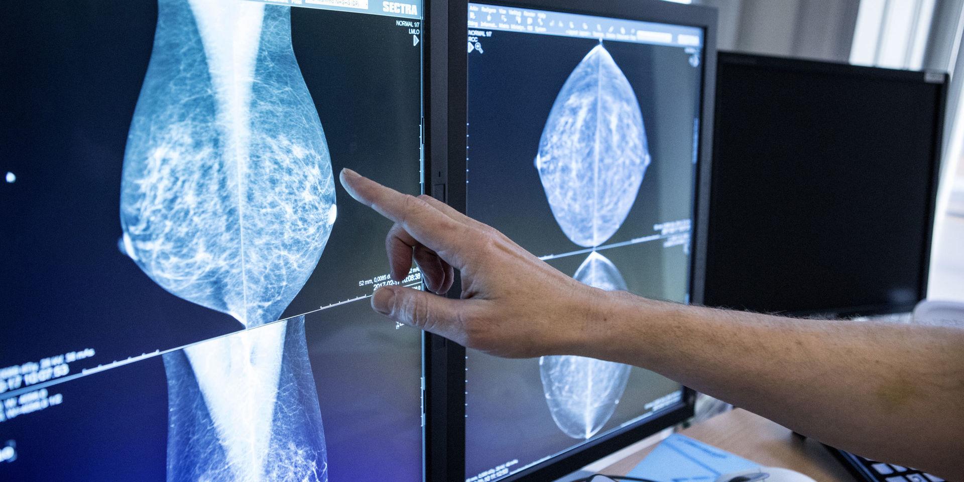  Trots att mammografin blev &quot;gratis&quot; 2016 har detta inte lett till att fler kvinnor gått på undersökningen, skriver debattörerna.
