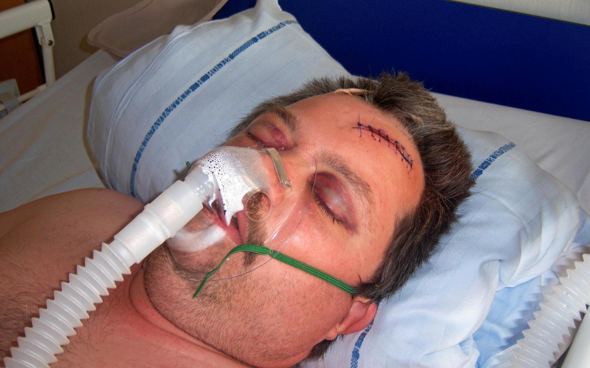 I maj för tio år sedan låg Jörgen Torstensson nedsövd efter att ha fått ett slag med ett järnrör över pannan.